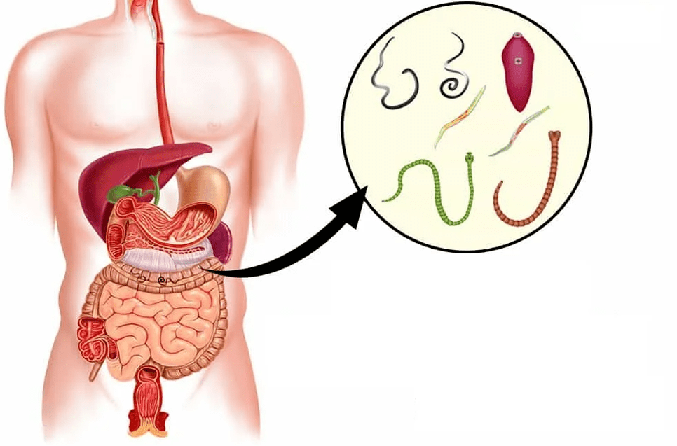 Helminths and worms in the gastrointestinal tract
