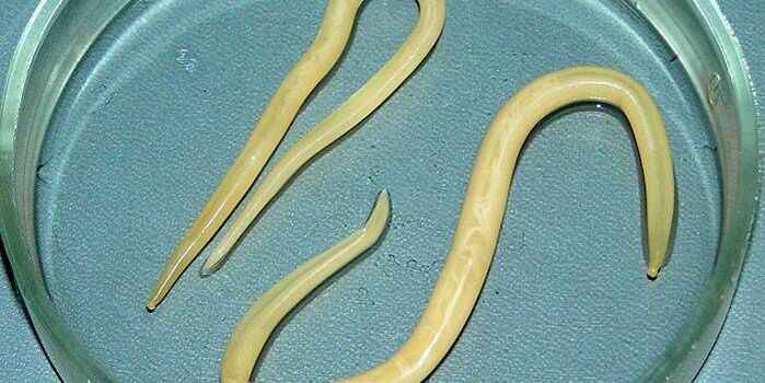 Human roundworms on a petri dish - parasitize on the walls of the small intestine