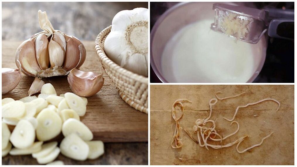 Garlic milk - a popular remedy for worms in children