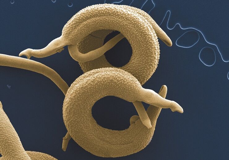 The types of parasites in the body