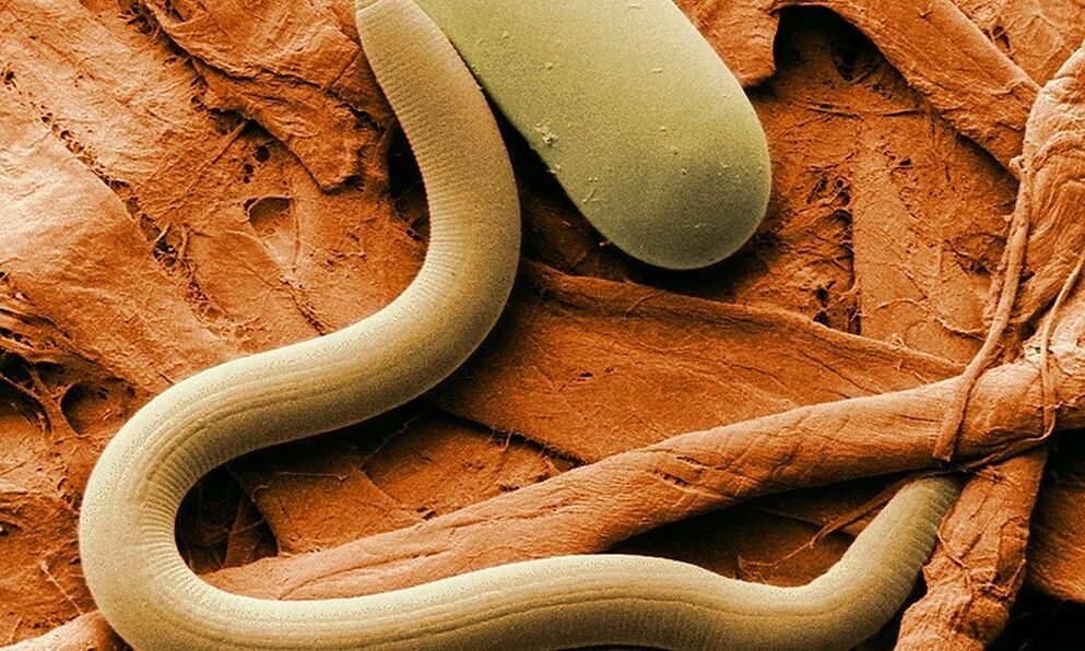 parasitic worms from the human body