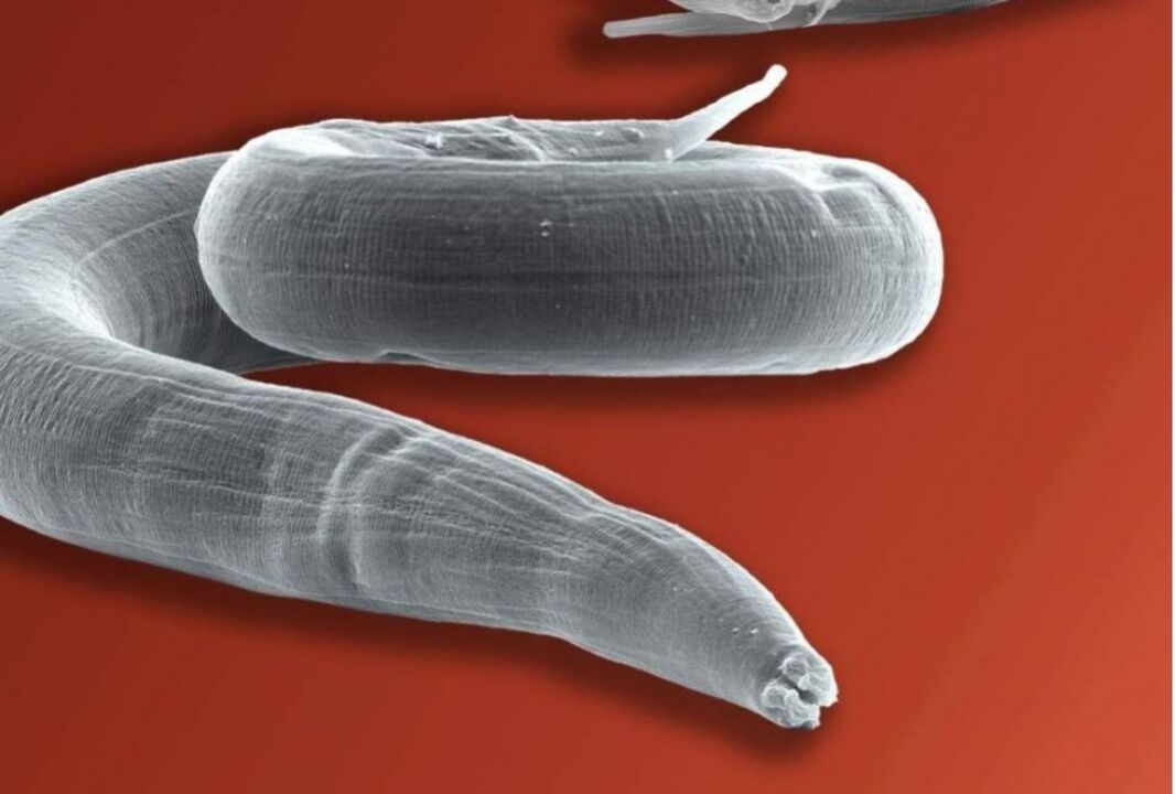 pink worm from the human body