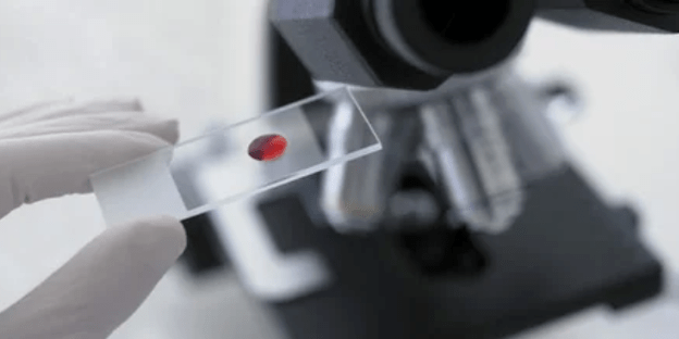 Blood test
