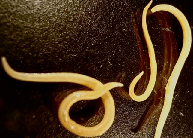 Protozoan worms